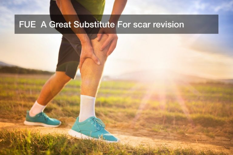 FUE  A Great Substitute For scar revision