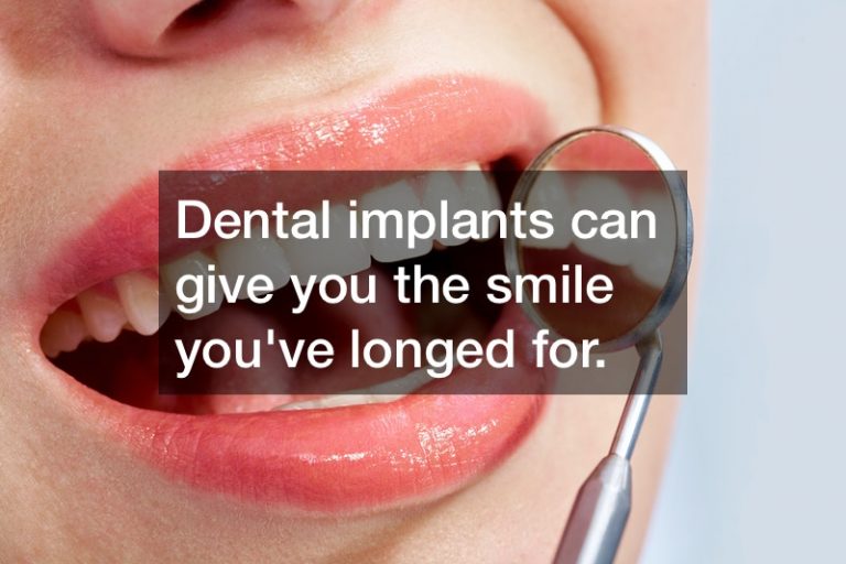 The Dental Implant Process