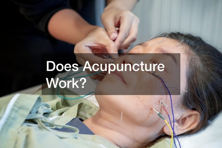 Does Acupuncture Work?